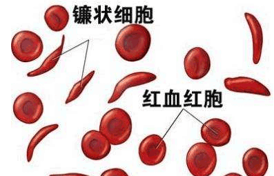 医用微量元素分析仪厂家谈孩子患缺铁性贫血