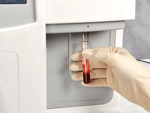 血细胞样本检测